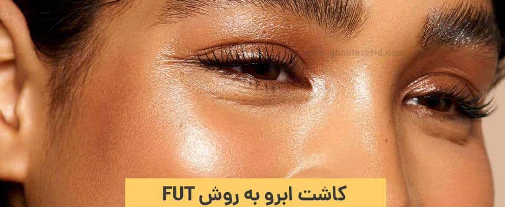 کاشت ابرو به روش Fut