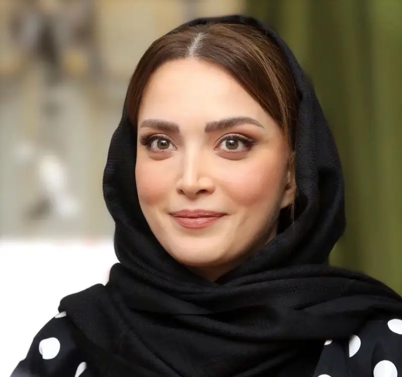 رازهای زیبایی بازیگران زن ایرانی؛ از رینوپلاستی تا کاشت مو