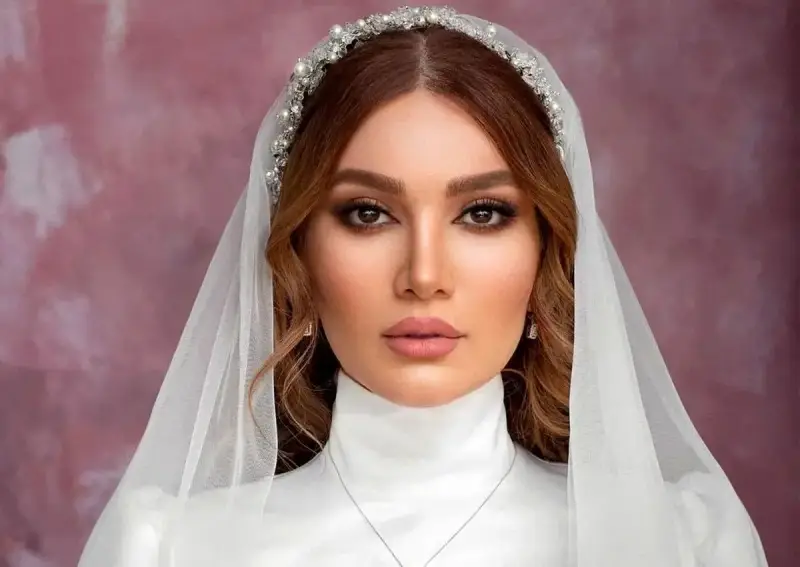 رازهای زیبایی بازیگران زن ایرانی؛ از رینوپلاستی تا کاشت مو