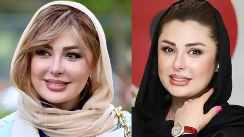 رازهای زیبایی بازیگران زن ایرانی؛ از رینوپلاستی تا کاشت مو