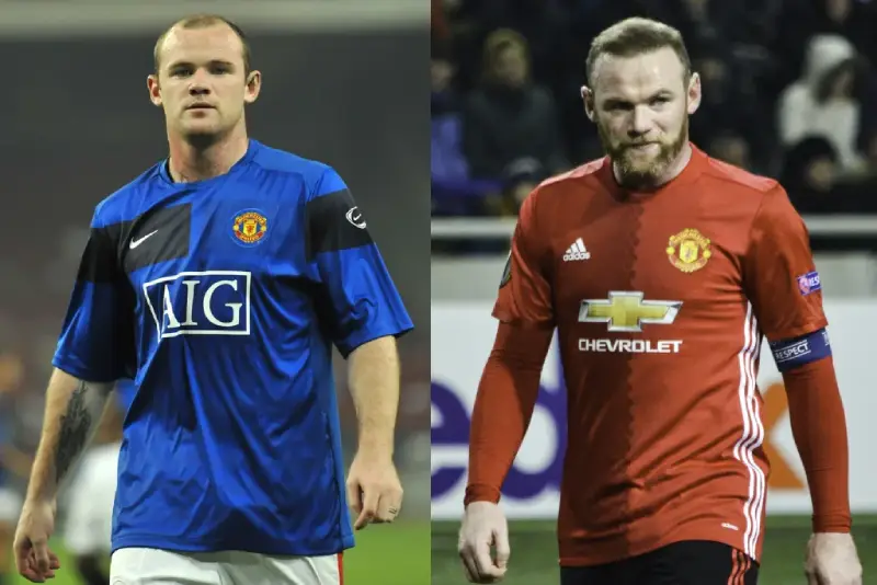 کاشت مو ستارگان هالیوود و راز بازگشت اعتمادبهنفس