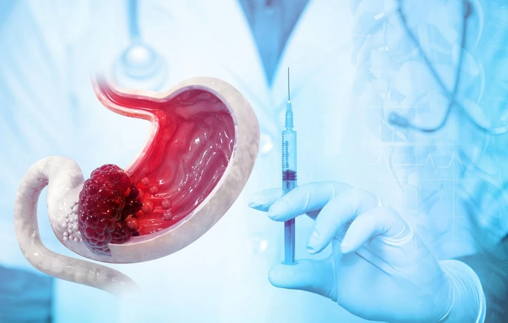 بوتاکس معده