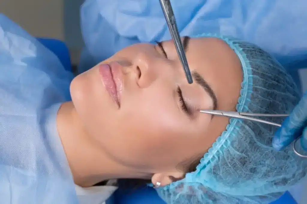 عمل کانتوپلاستی یا چشم گربه‌ای چیست؟ همه چیز درباره جراحی کشیده کردن چشم