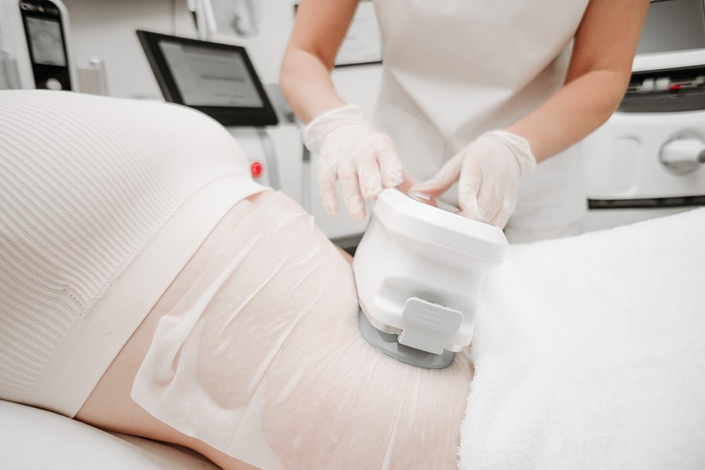 کرایولیپولیز