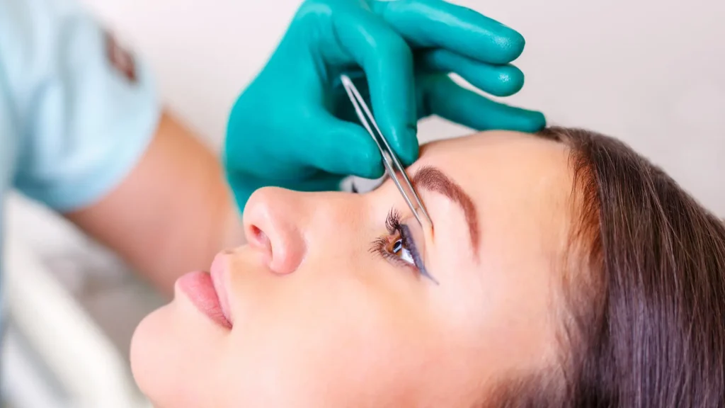 عمل چشم روباهی چیست؟ | مراحل، مزایا، هزینه