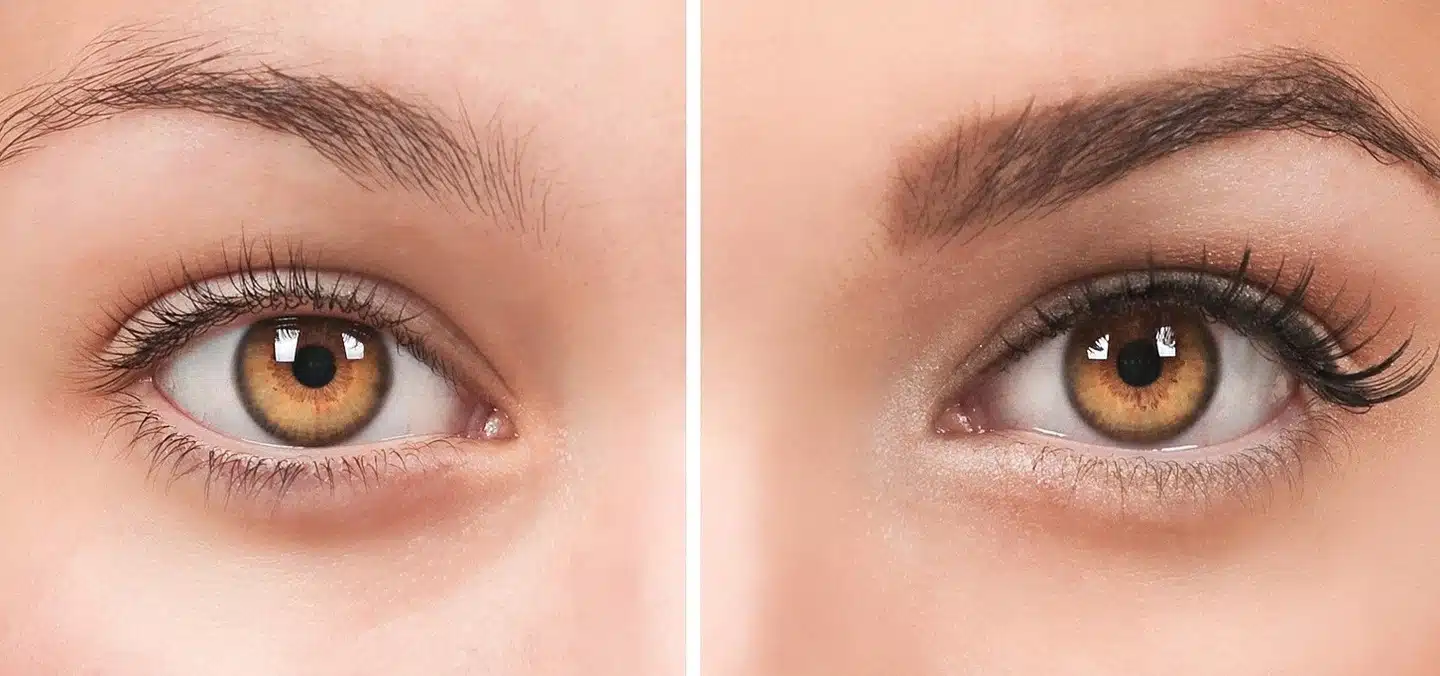 نکات طلایی قبل و بعد از کاشت ابرو