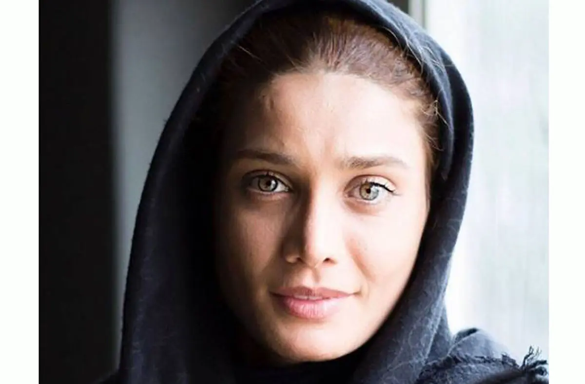 عملهای زیبایی تینا آخوند تبار | قبل و بعد، واقعیتها و تاثیر بر چهره