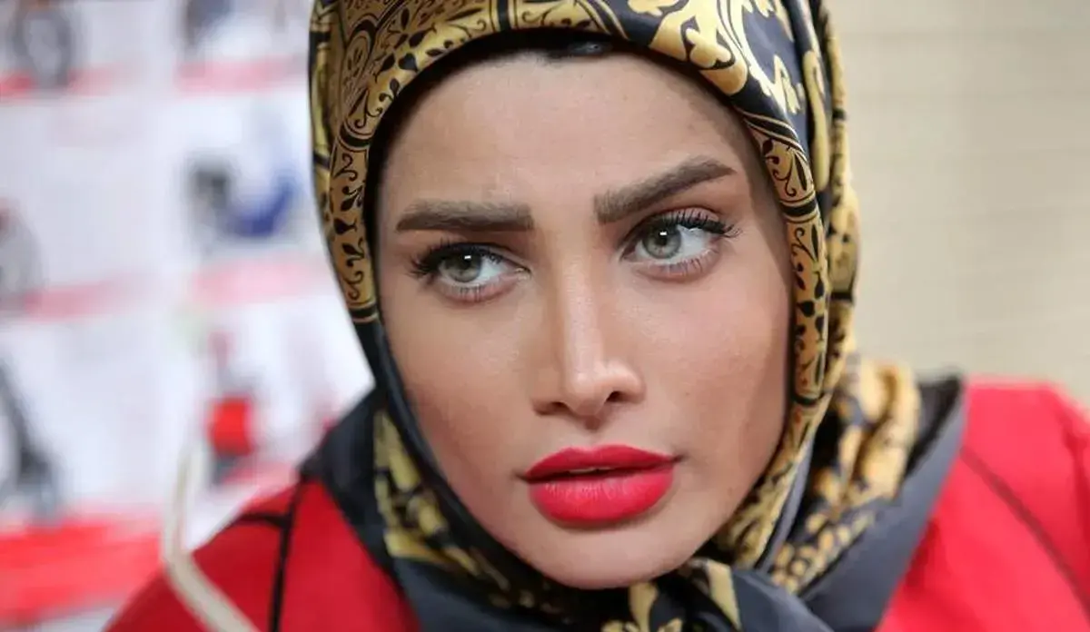 عملهای زیبایی تینا آخوند تبار | قبل و بعد، واقعیتها و تاثیر بر چهره